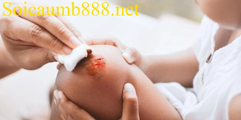 Dự đoán điềm báo chung của giấc mơ thấy bị thương